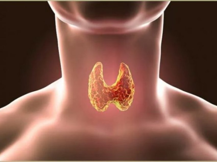 Ushqimet që duhen shmangur sepse përkeqësojnë tiroiden