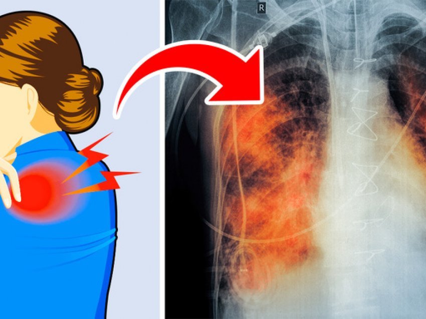 Dhimbja e shpinës mund të jetë një simptomë e Covid-19