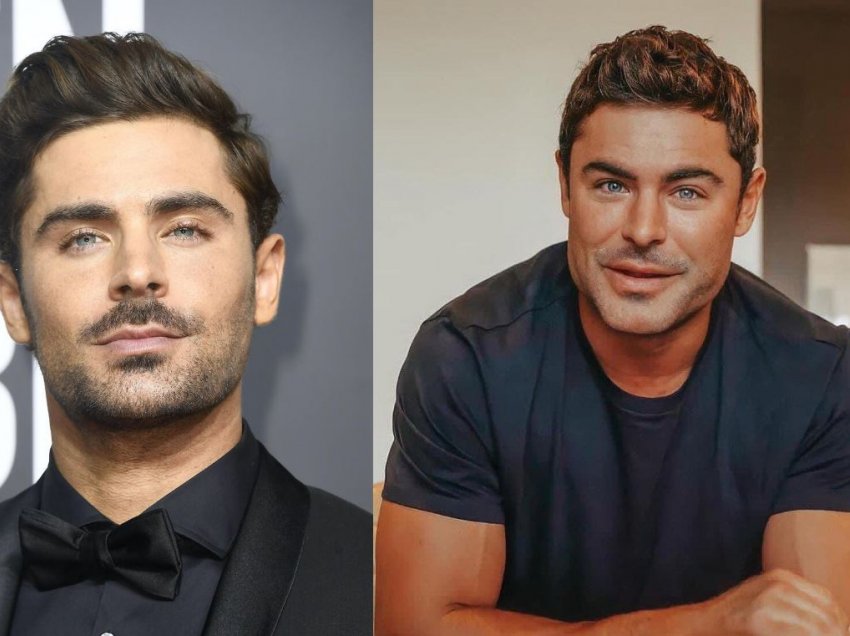 Pamja e tij e re “çmendi” gjithë botën, kirurgu plastik shpjegon çfarë ka ndodhur me fytyrën e Zac Efron