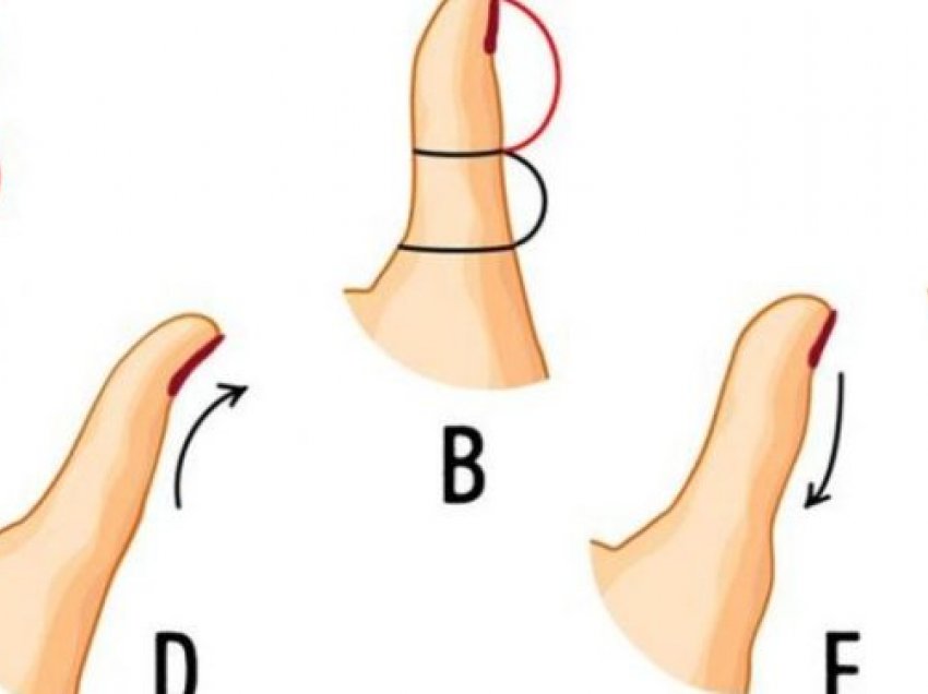 Forma e gishtit mund të zbulojë shumë rreth personalitetit!
