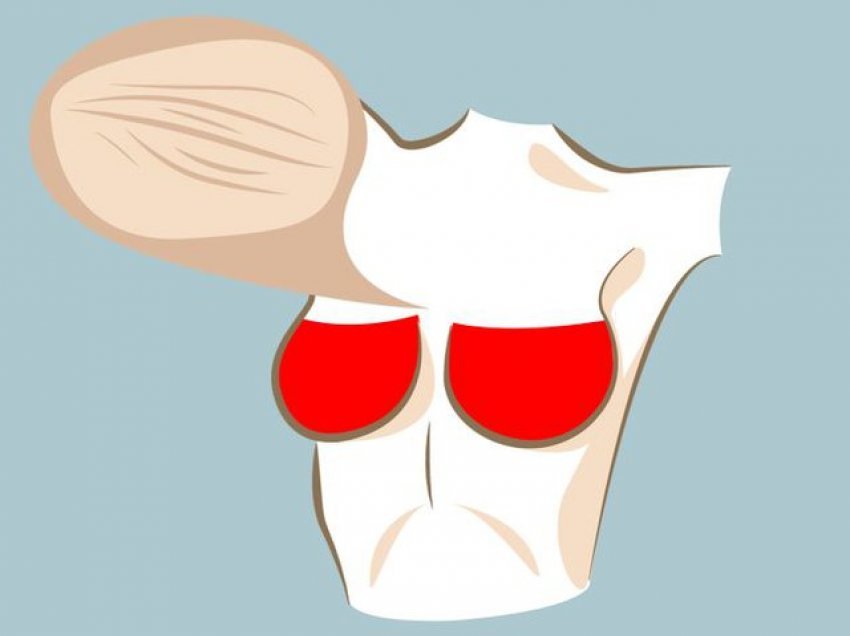 Nuk është faji i vapës, ja përse keni vazhdimisht skuqje dhe kruajtje të gjoksit