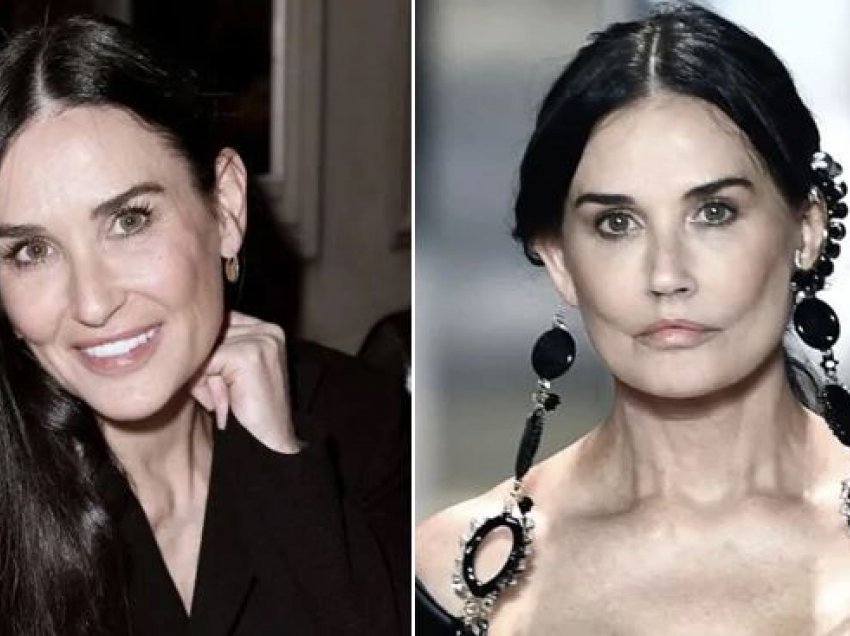 Fansat thonë se Demi Moore-n e kanë tjetërsuar operacionet plastike