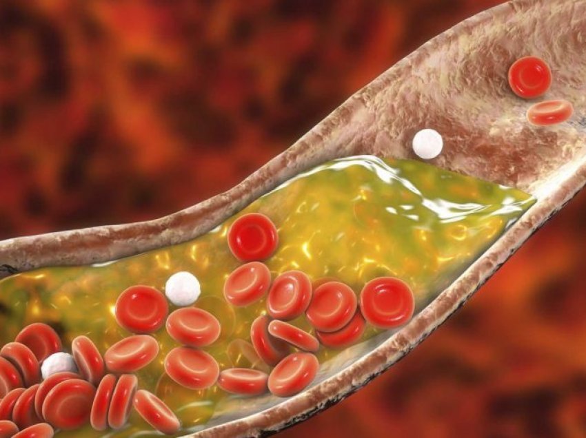 Zbuloni si ndikon aktiviteti fizik në uljen e kolesterolit