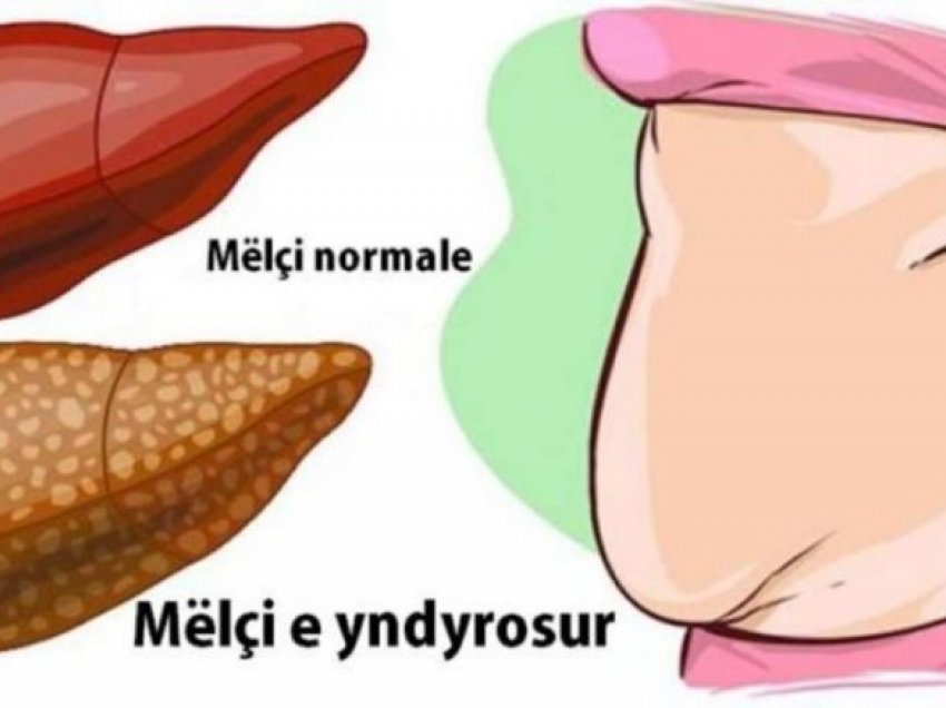 Nga kockat e dobëta deri te mëlçia e dhjamosur, roli i proteinave në shëndetin tonë