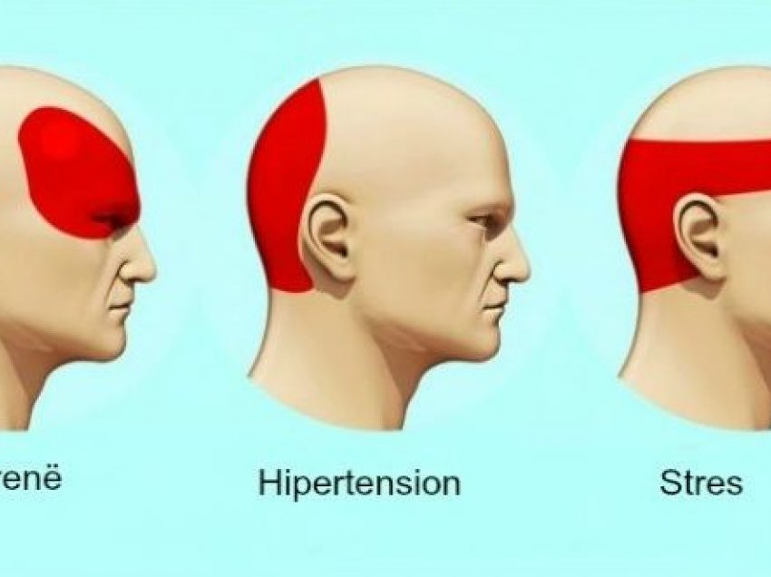 Mësoni se pse keni dhimbje koke