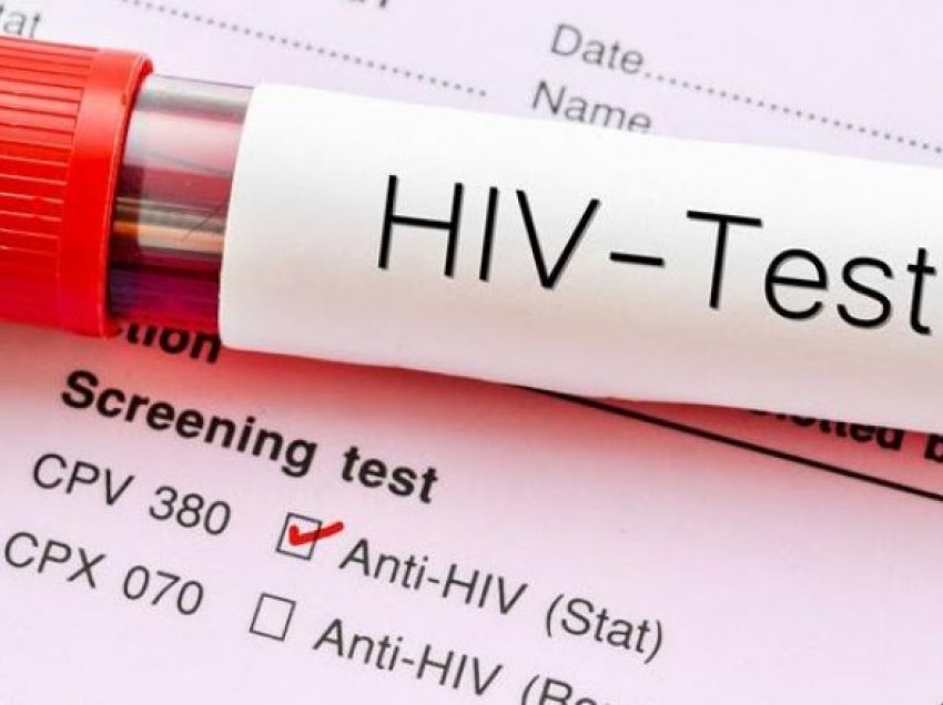 Më shumë meshkuj nën 20 vjeç të prekur nga HIV/AIDS në Shqipëri