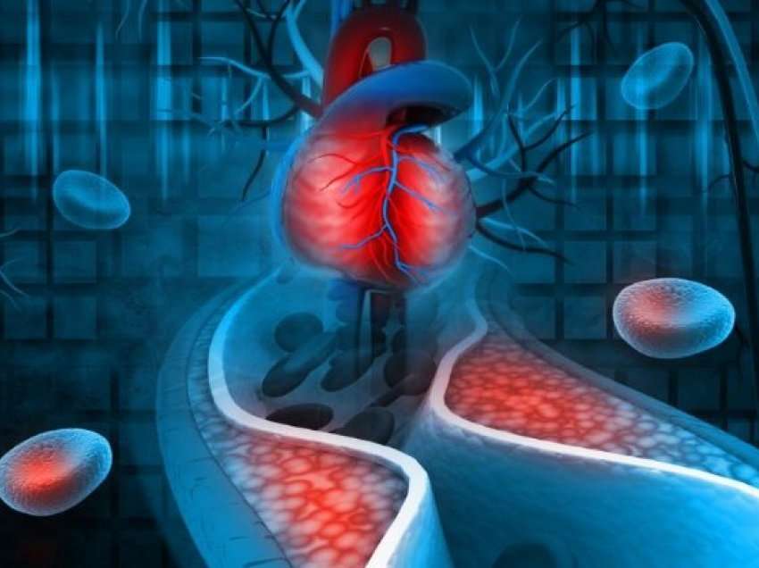 Risk madhor, niveli i kolesterolit në gjak nuk duhet neglizhuar