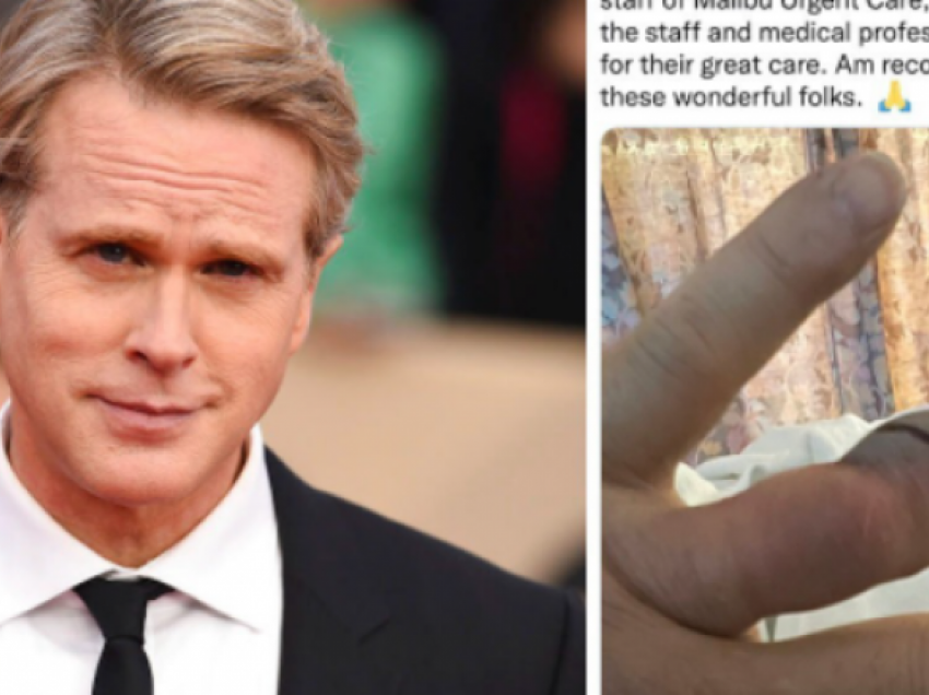 E kafshoi gjarpri, aktori Cary Elwes dërgohet me urgjencë në spital me helikopter