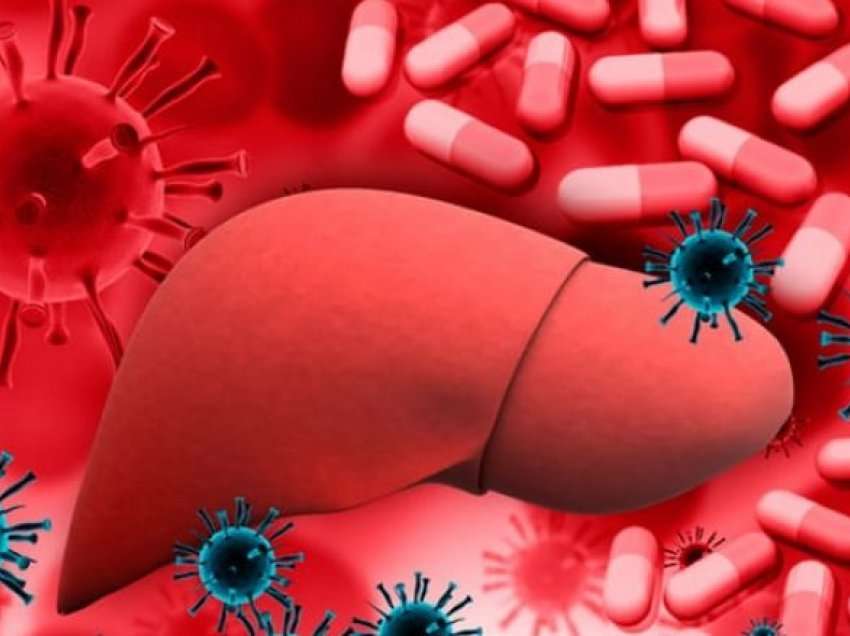 Çfarë e shkakton hepatitin dhe cilat janë simptomat kryesore që duhen pasur parasysh?