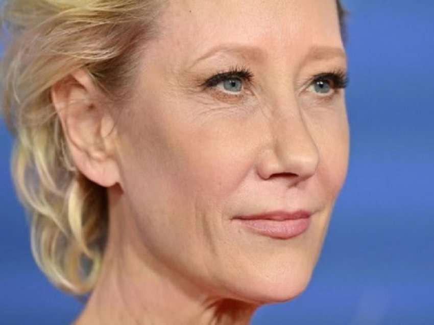 Aktorja Anne Heche në gjendje kritike pas aksidentit