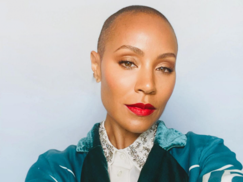 Çfarë e shkakton alopecinë dhe çfarë ka thënë Jada Pinkett Smith për gjendjen e saj