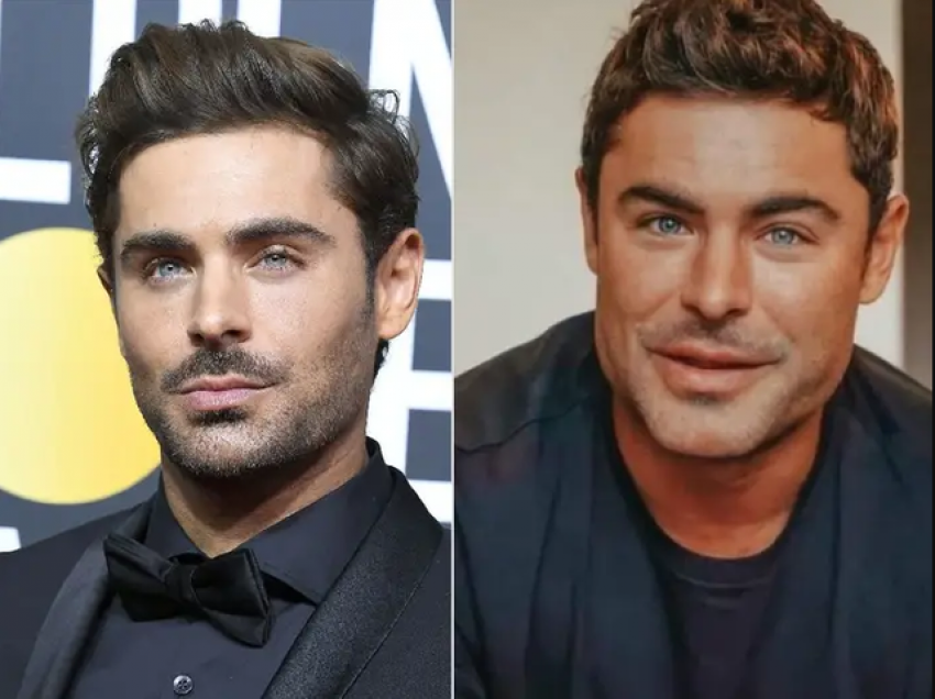 Operacione plastike në fytyrë? Zac Efron rrëfen përvojën e keqe: Për pak vdiqa