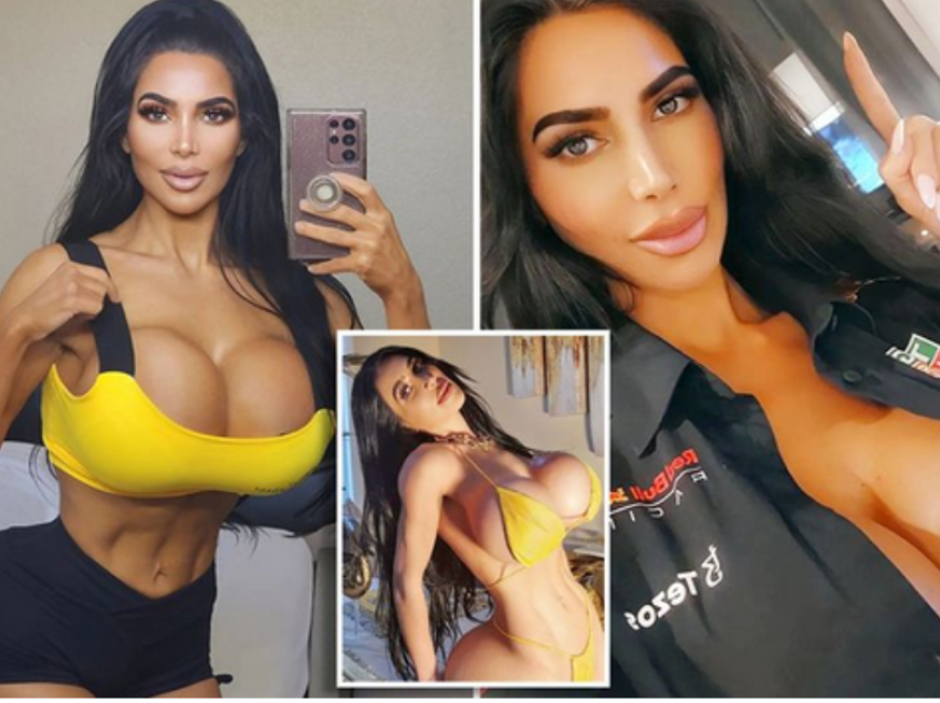 Modelja ‘sozi’ e Kim Kardashian vdes gjatë operacionit të dështuar plastik 