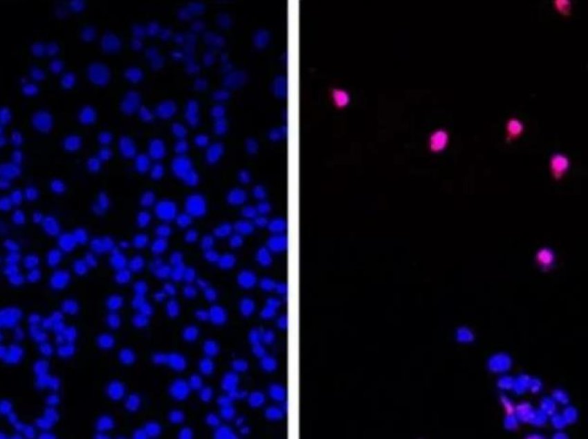 Tableta kundër kancerit filloi të testohet te njerëzit: Shkatërron kanceret e ngurta