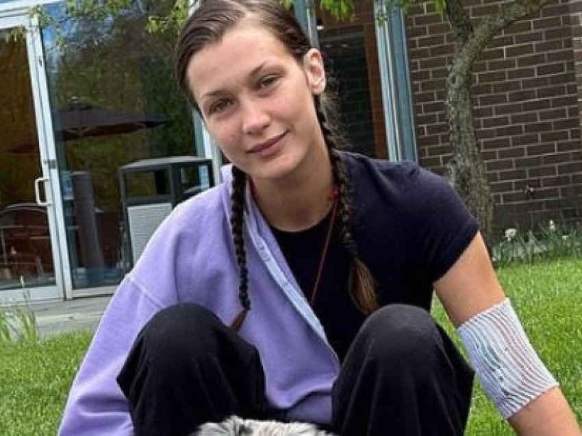 Bella Hadid rikthehet në rrjetet sociale për të dokumentuar betejën me sëmundjen Lyme