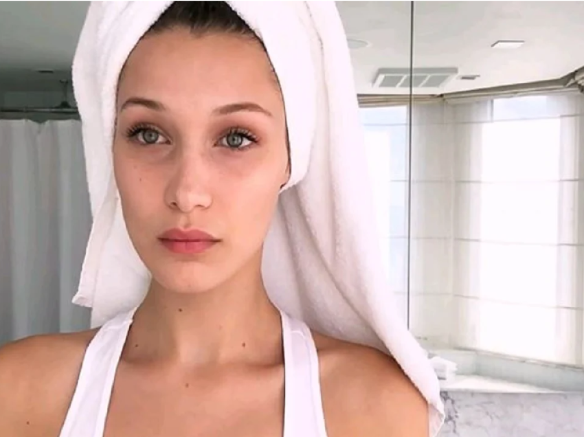 Sëmundja nga e cila vuan Bella Hadid, të cilën të gjithë e kemi përjetuar të paktën një herë!