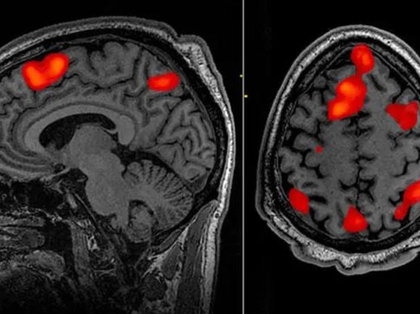 Inteligjenca Artificiale arrin ta lexojë trurin pa metodë invazive