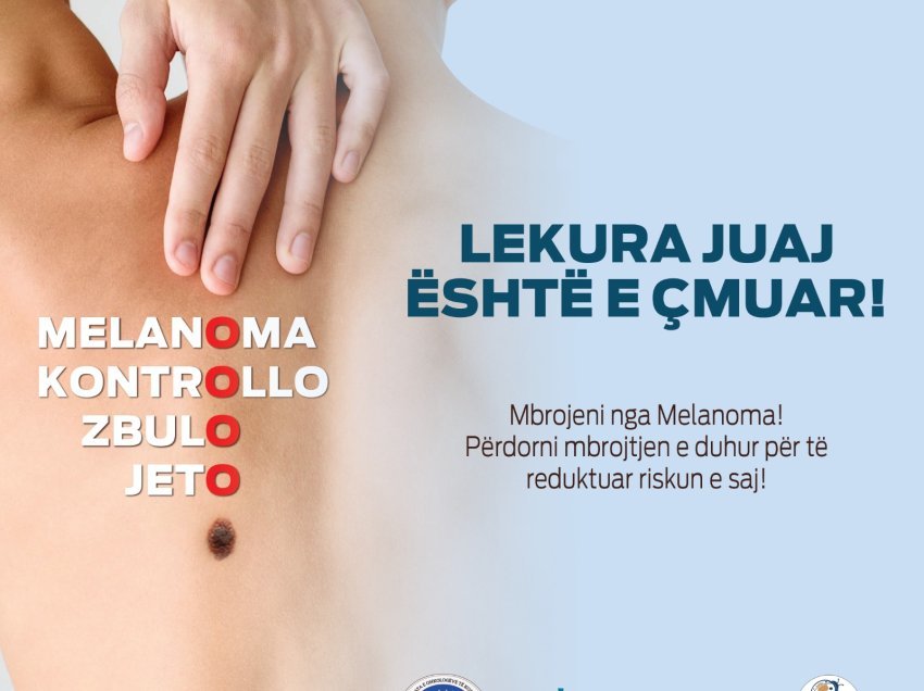 Ligjërata e ekzaminime falas nesër në Ditën e Ndërgjegjësimit për Melanomën