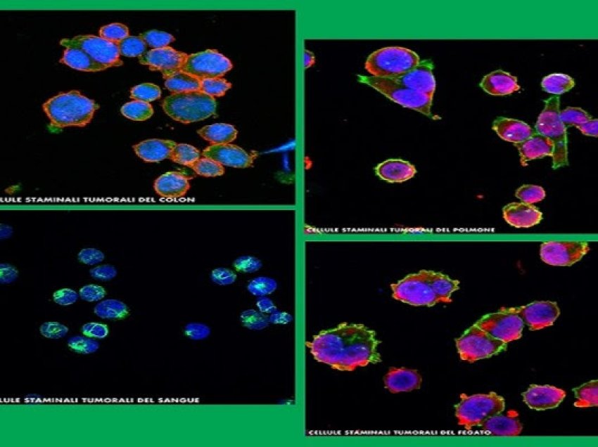 ​Italianët gjejnë një nga “motorët” pas kancerit të pankreasit