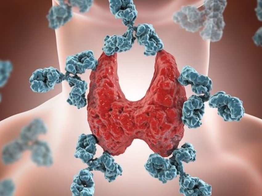 Sëmundja e Hashimotos, si ndihmon mënyra e të ushqyerit dhe stili i jetesës