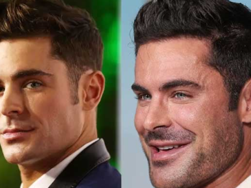 Kirurgu plastik zbulon se çfarë ka ndodhur me fytyrën e Zac Efron