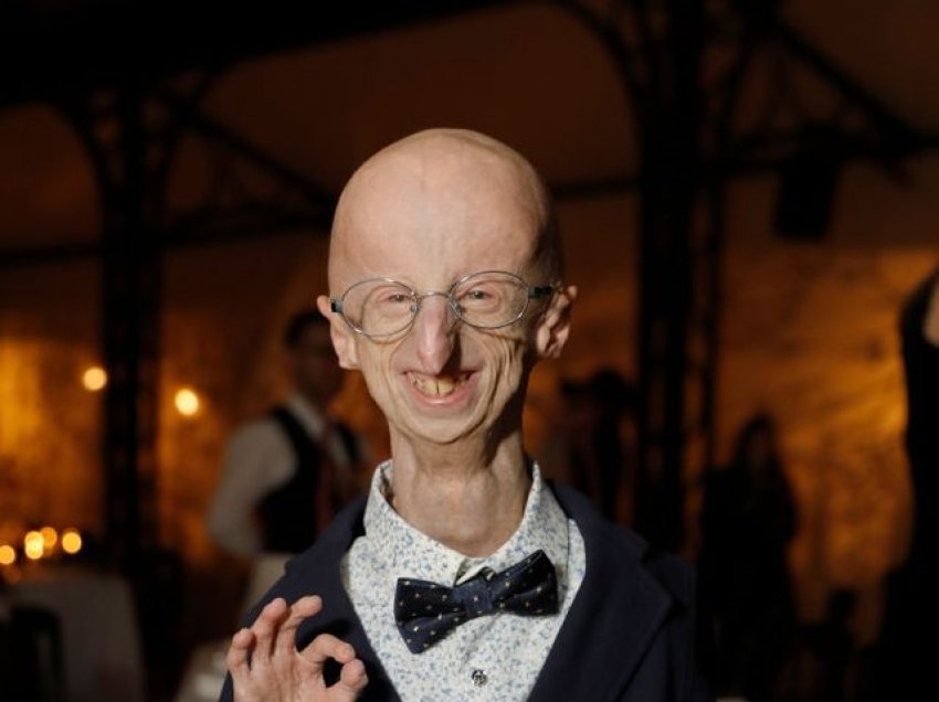 Progeria, çrregullimi i rrallë gjenetik që shkakton plakjen e parakohëshme të njeriut!