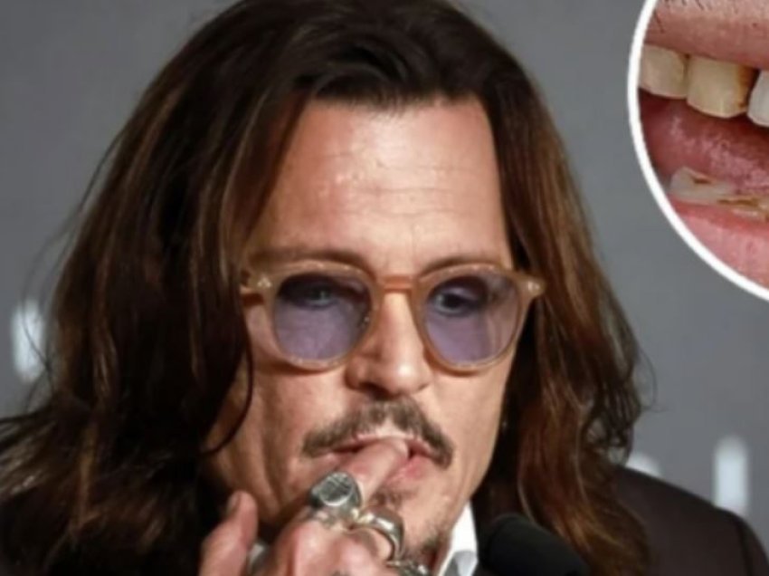 Më në fund: Johnny Depp rregullon dhëmbët