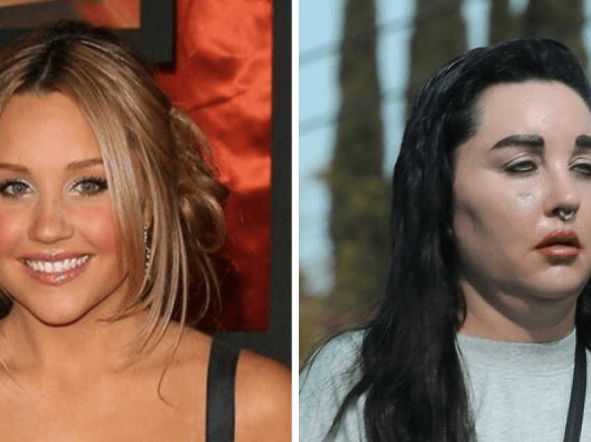 Ndryshimi drastik i aktores amerikane Amanda Bynes, çfarë ka ndodhur me të?