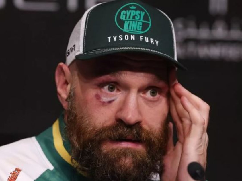 Tyson Fury do të bëjë ‘njoftim serioz’ vetëm disa javë pasi doli në pension